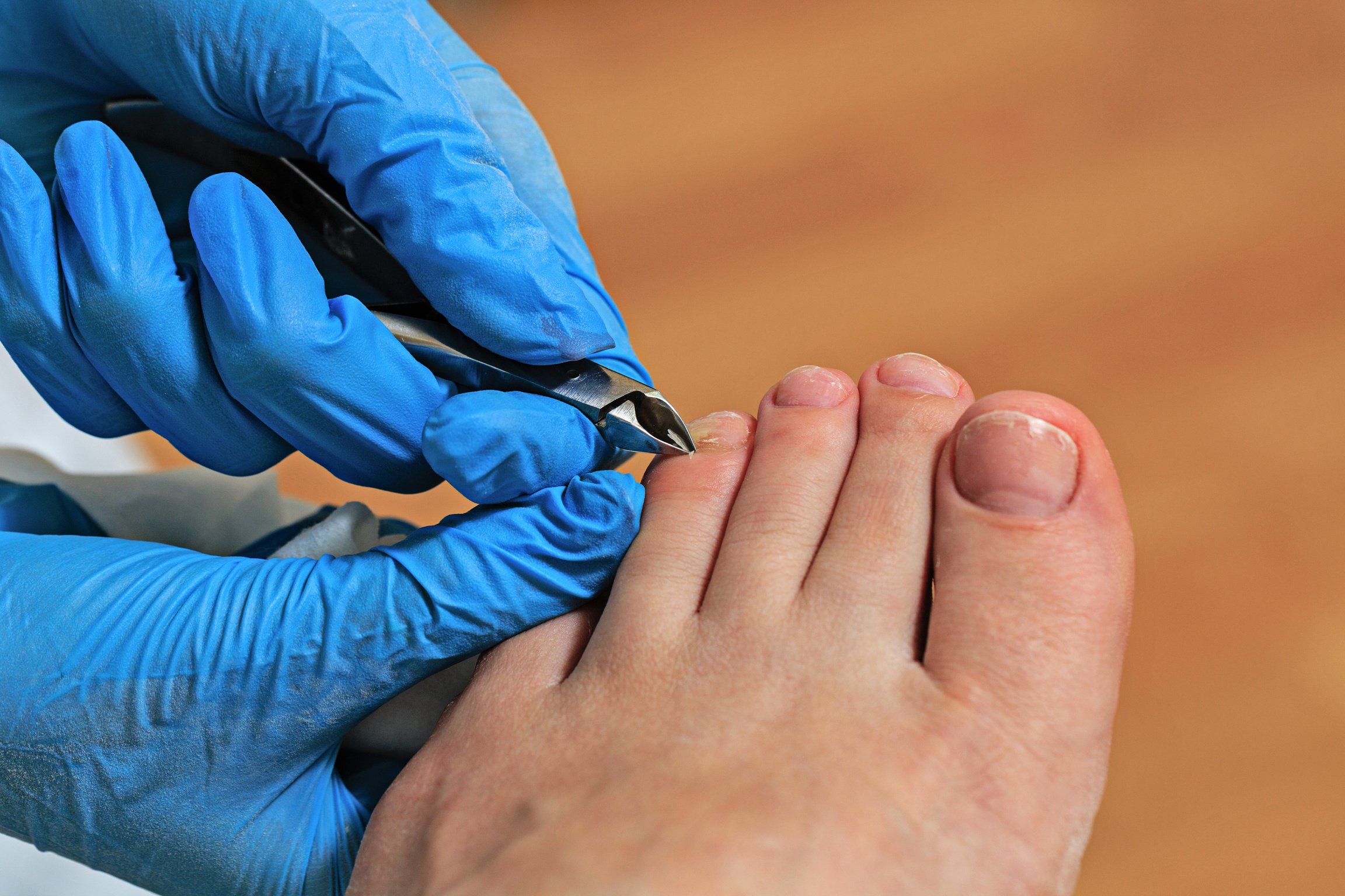 Chiropody